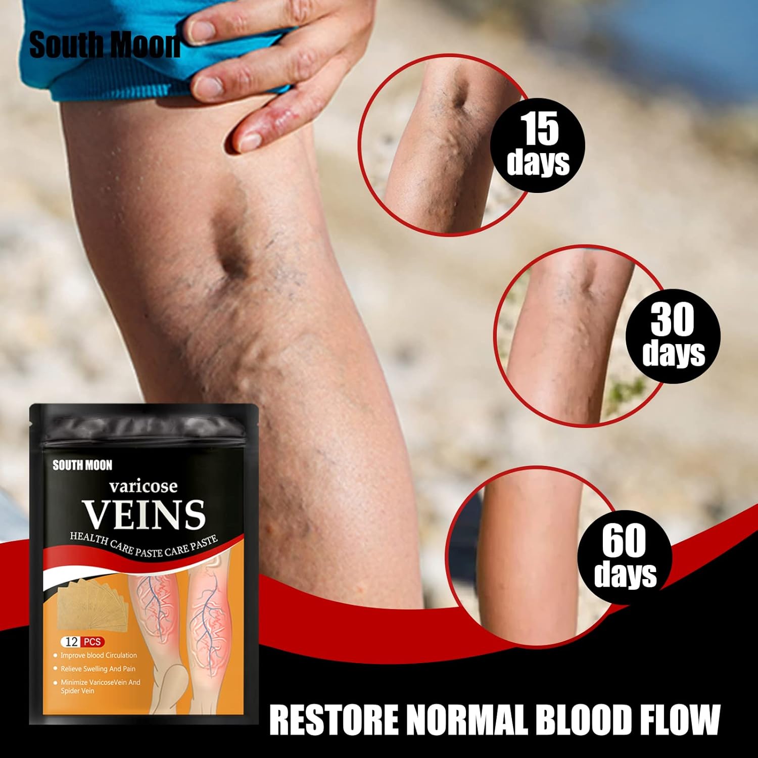 Parches para varices